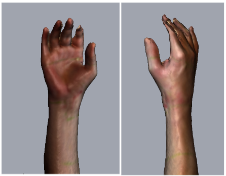 Case Study: Return-to-Duty With A Novel Treatment Approach for